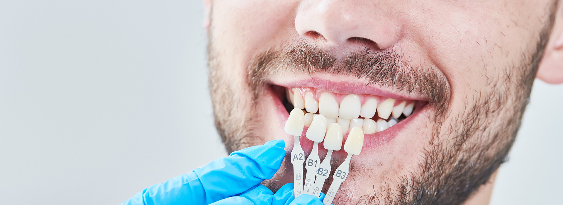 All Kids Dental Care | Dental Bridges, Inlays  amp  Onlays and Night Guards